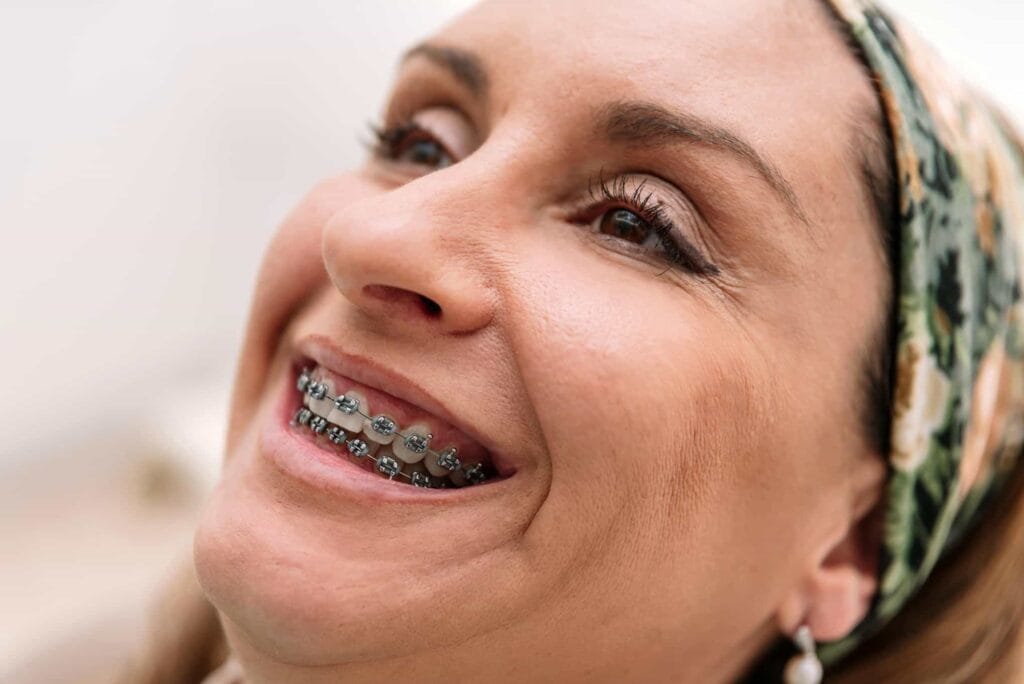 Close Up Of A Smiling Female Patient With Braces D Utc