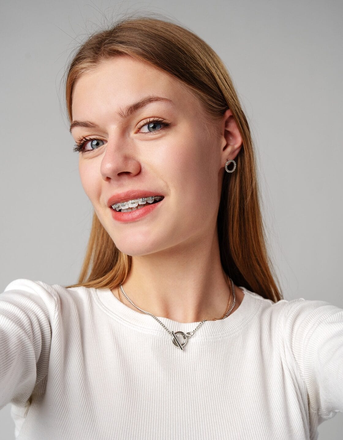 Young Woman With Dental Braces Close Up Utc E